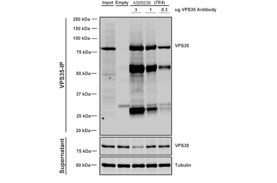 Immunoprecipitation - Anti-VPS35 Antibody [7E4] (A305036) - Antibodies.com