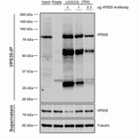 Immunoprecipitation - Anti-VPS35 Antibody [7E4] (A305036) - Antibodies.com