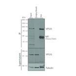 Immunoprecipitation - Anti-VPS35 Antibody [7E4] (A305036) - Antibodies.com