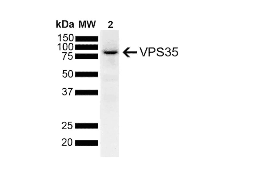 Western Blot - Anti-VPS35 Antibody [7E4] (A305036) - Antibodies.com