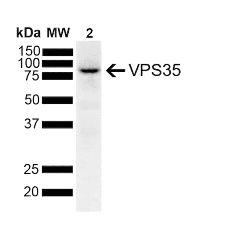 Western Blot - Anti-VPS35 Antibody [7E4] (A305036) - Antibodies.com