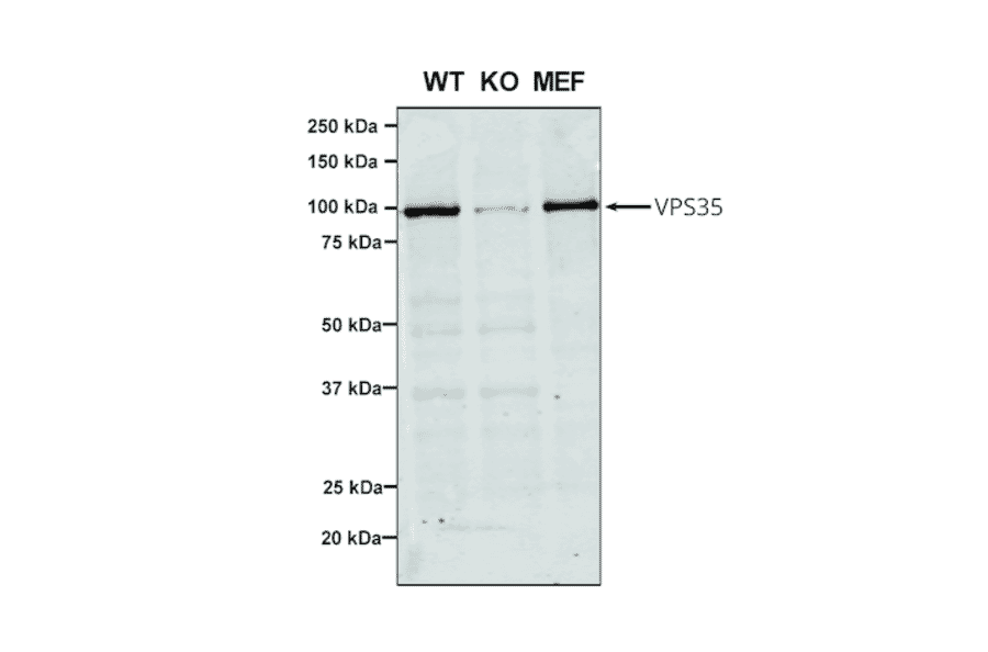 Western Blot - Anti-VPS35 Antibody [7E4] (A305036) - Antibodies.com