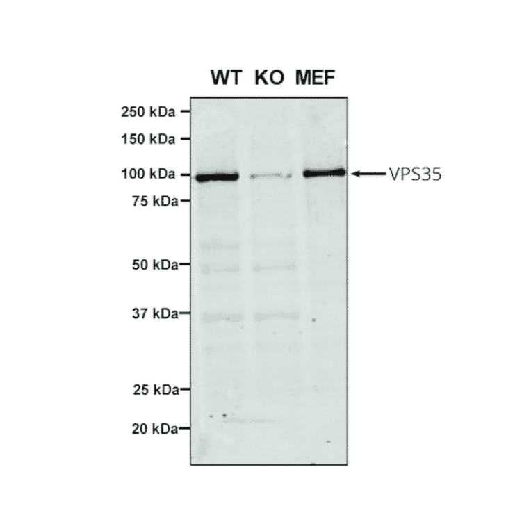Western Blot - Anti-VPS35 Antibody [7E4] (A305036) - Antibodies.com