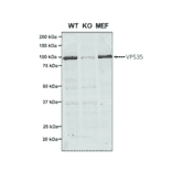 Western Blot - Anti-VPS35 Antibody [7E4] (A305036) - Antibodies.com