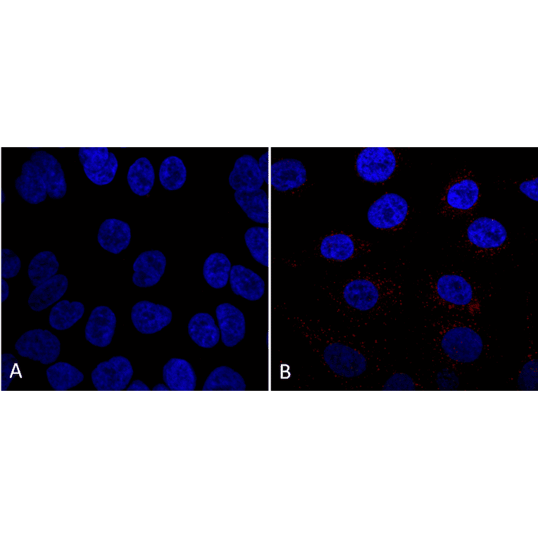 Immunocytochemistry/Immunofluorescence - Anti-VPS35 Antibody [7E4] (A305036) - Antibodies.com