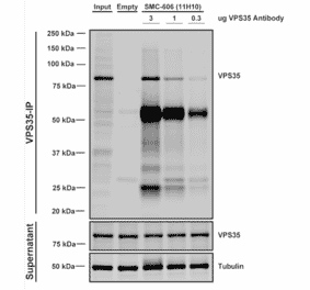 Immunoprecipitation - Anti-VPS35 Antibody [11H10] (A305037) - Antibodies.com