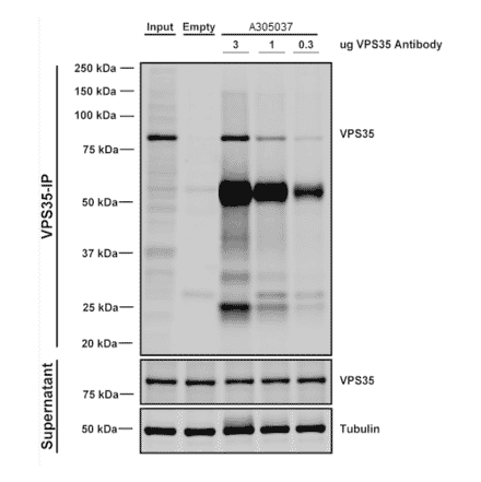 Immunoprecipitation - Anti-VPS35 Antibody [11H10] (A305037) - Antibodies.com