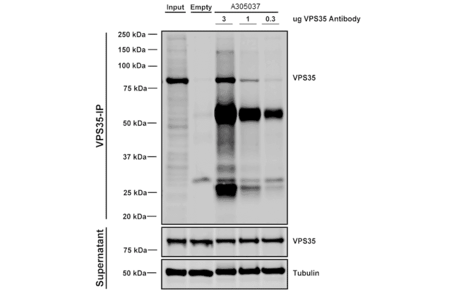 Immunoprecipitation - Anti-VPS35 Antibody [11H10] (A305037) - Antibodies.com
