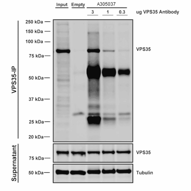 Immunoprecipitation - Anti-VPS35 Antibody [11H10] (A305037) - Antibodies.com