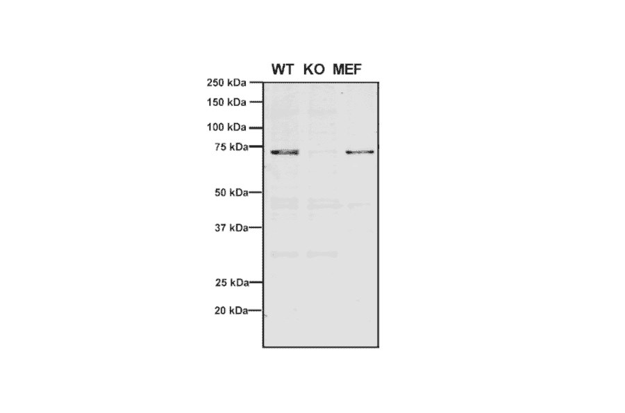 Western Blot - Anti-VPS35 Antibody [11H10] (A305037) - Antibodies.com