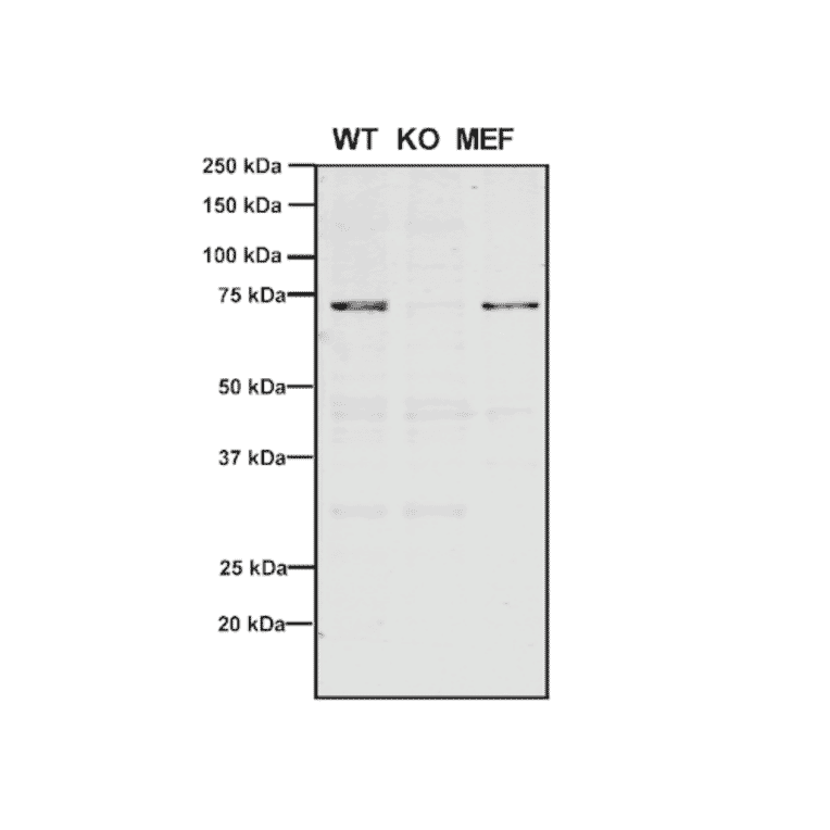 Western Blot - Anti-VPS35 Antibody [11H10] (A305037) - Antibodies.com