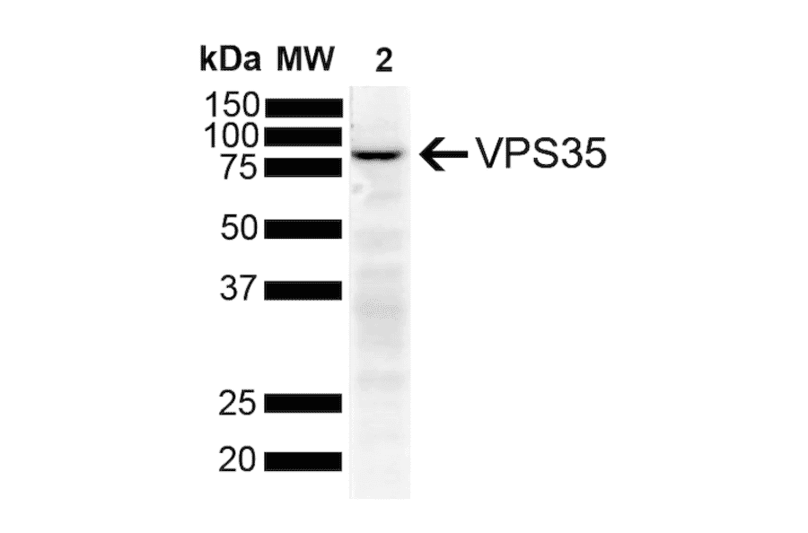 Western Blot - Anti-VPS35 Antibody [11H10] (A305037) - Antibodies.com