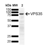 Western Blot - Anti-VPS35 Antibody [11H10] (A305037) - Antibodies.com