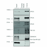 Immunoprecipitation - Anti-VPS35 Antibody [11H10] (A305037) - Antibodies.com