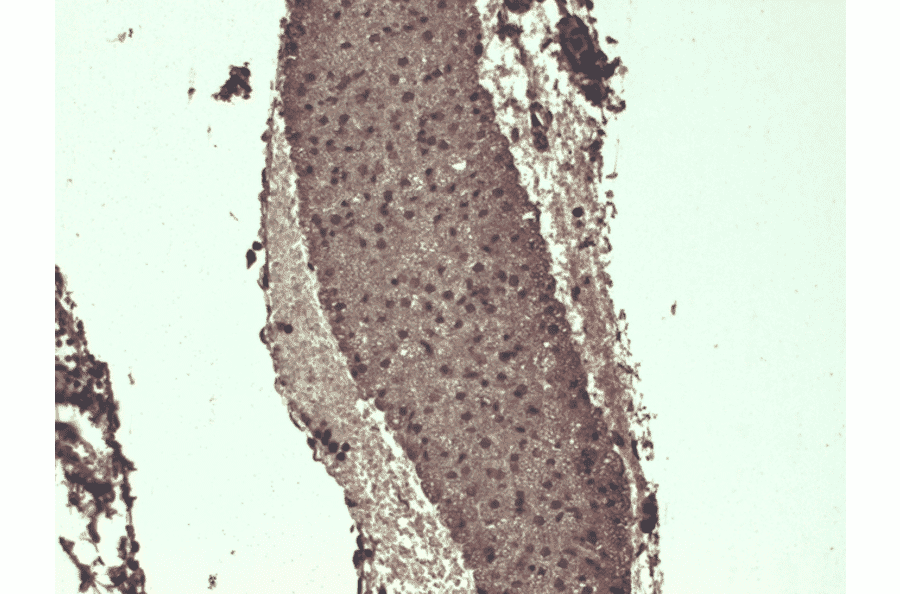 Immunohistochemistry - Anti-Sodium Iodide Symporter Antibody [FP5] (A305038) - Antibodies.com