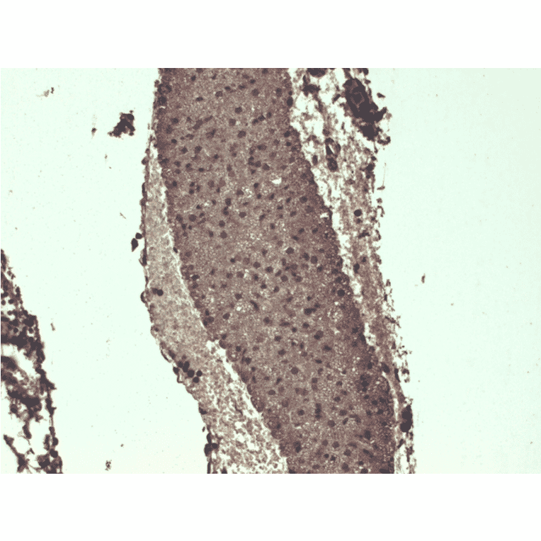 Immunohistochemistry - Anti-Sodium Iodide Symporter Antibody [FP5] (A305038) - Antibodies.com