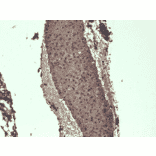 Immunohistochemistry - Anti-Sodium Iodide Symporter Antibody [FP5] (A305038) - Antibodies.com
