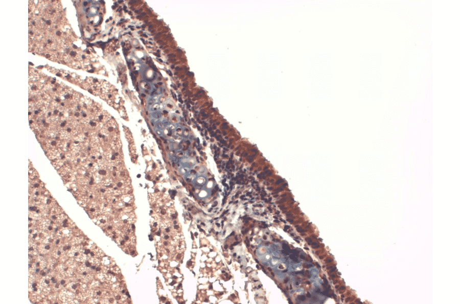 Immunohistochemistry - Anti-Sodium Iodide Symporter Antibody [FP5] (A305038) - Antibodies.com