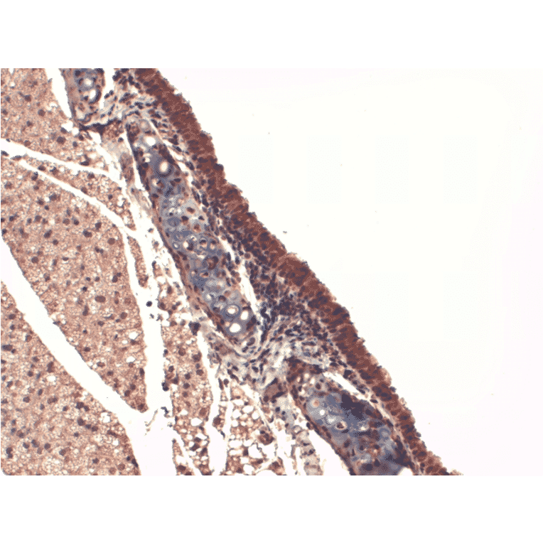 Immunohistochemistry - Anti-Sodium Iodide Symporter Antibody [FP5] (A305038) - Antibodies.com