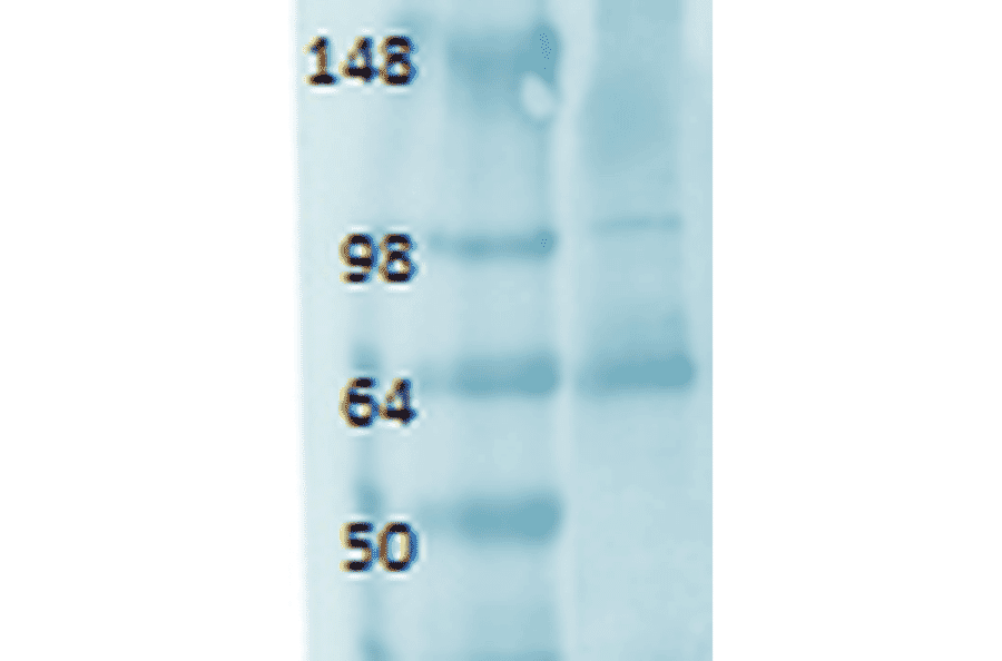 Western Blot - Anti-Sodium Iodide Symporter Antibody [FP5] (A305038) - Antibodies.com