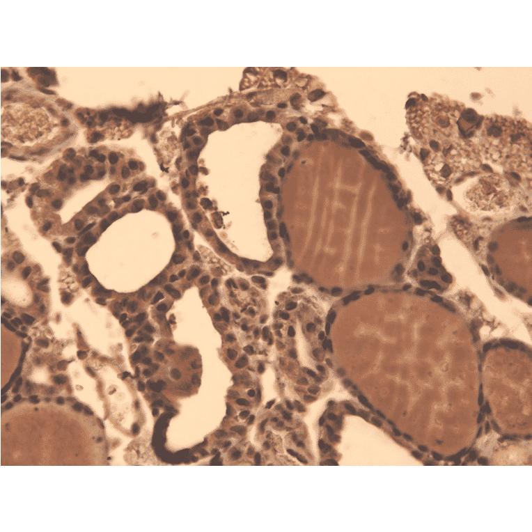 Immunohistochemistry - Anti-Sodium Iodide Symporter Antibody [FP5] (A305038) - Antibodies.com