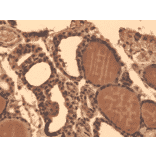 Immunohistochemistry - Anti-Sodium Iodide Symporter Antibody [FP5] (A305038) - Antibodies.com
