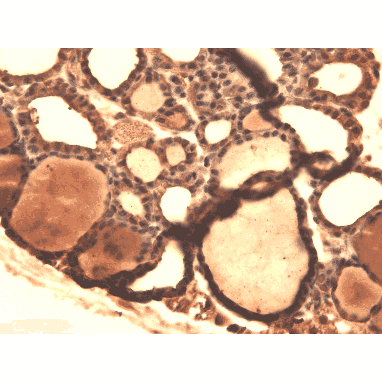 Immunohistochemistry - Anti-Sodium Iodide Symporter Antibody [14F] (A305039) - Antibodies.com