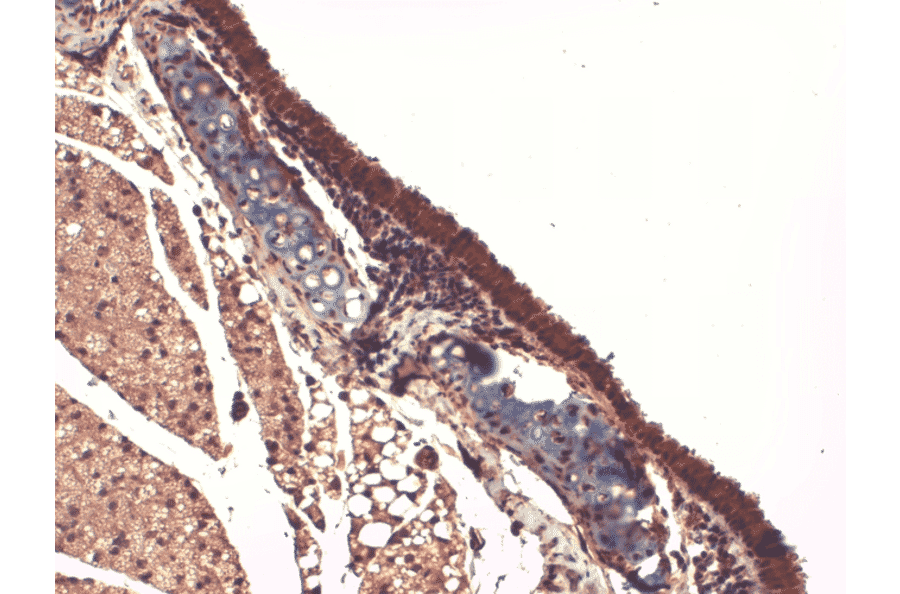 Immunohistochemistry - Anti-Sodium Iodide Symporter Antibody [14F] (A305039) - Antibodies.com
