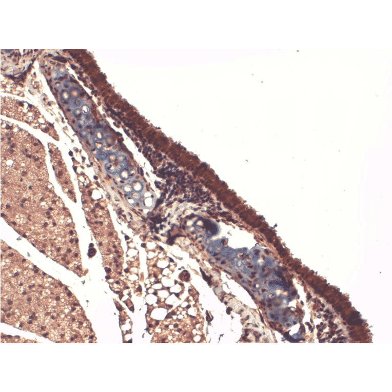 Immunohistochemistry - Anti-Sodium Iodide Symporter Antibody [14F] (A305039) - Antibodies.com