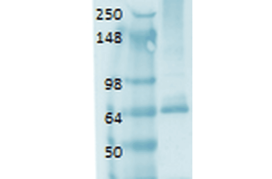 Western Blot - Anti-Sodium Iodide Symporter Antibody [14F] (A305039) - Antibodies.com