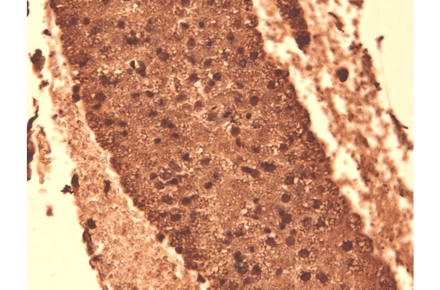 Immunohistochemistry - Anti-Sodium Iodide Symporter Antibody [14F] (A305039) - Antibodies.com