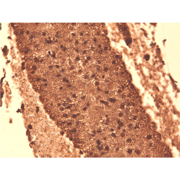 Immunohistochemistry - Anti-Sodium Iodide Symporter Antibody [14F] (A305039) - Antibodies.com