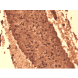 Immunohistochemistry - Anti-Sodium Iodide Symporter Antibody [14F] (A305039) - Antibodies.com