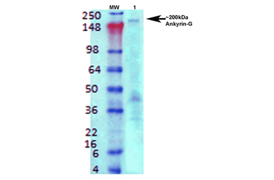 Western Blot - Anti-ANK-3 Antibody [S106-20] (A305040) - Antibodies.com