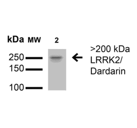 Western Blot - Anti-LRRK2 Antibody [S138-6] (A305041) - Antibodies.com