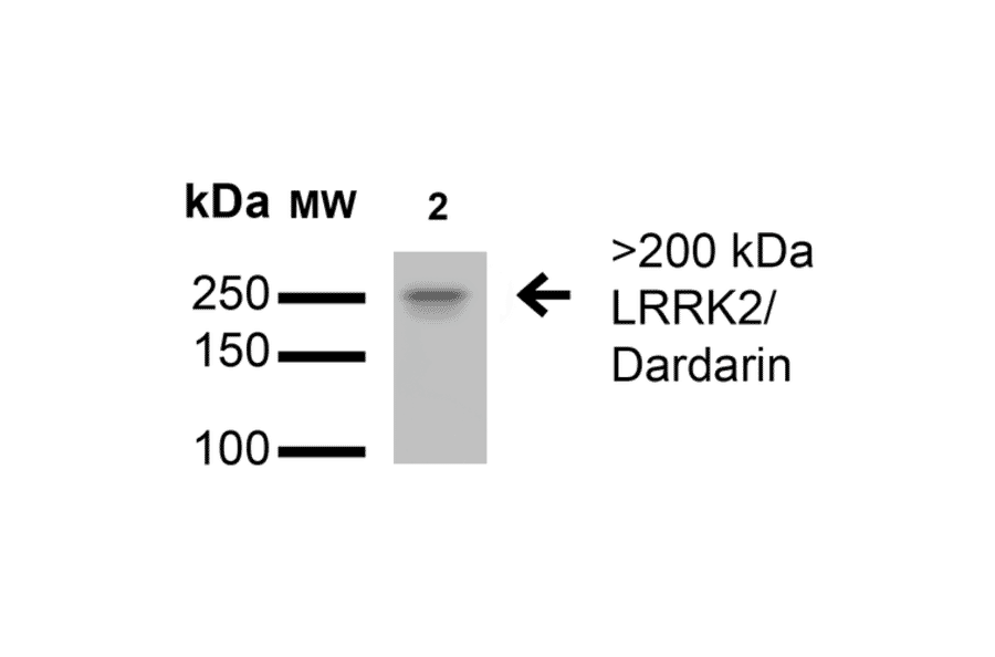 Western Blot - Anti-LRRK2 Antibody [S138-6] (A305041) - Antibodies.com