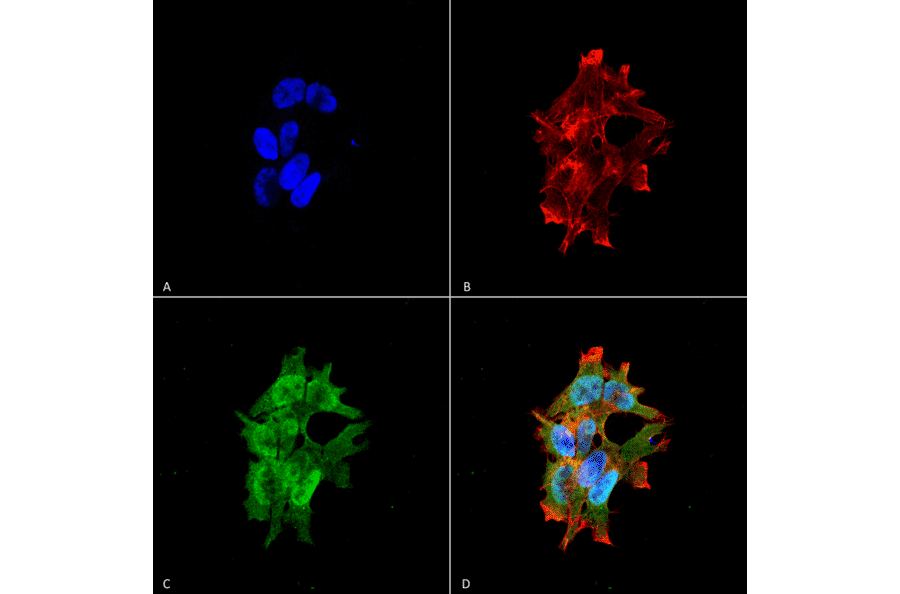 Immunocytochemistry/Immunofluorescence - Anti-LRRK2 Antibody [S138-6] (A305041) - Antibodies.com