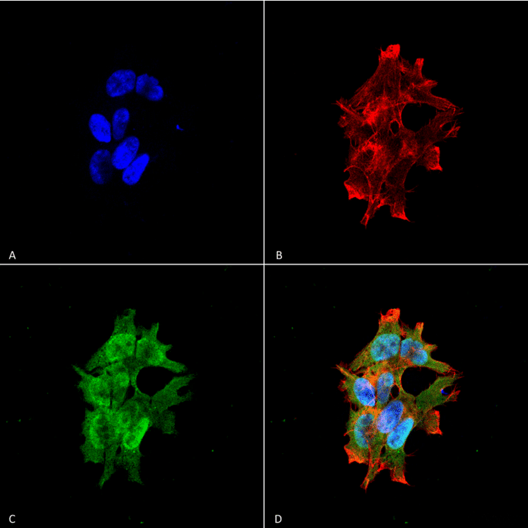 Immunocytochemistry/Immunofluorescence - Anti-LRRK2 Antibody [S138-6] (A305041) - Antibodies.com