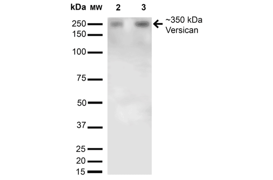 Western Blot - Anti-Versican Antibody [S351-23] (A305042) - Antibodies.com