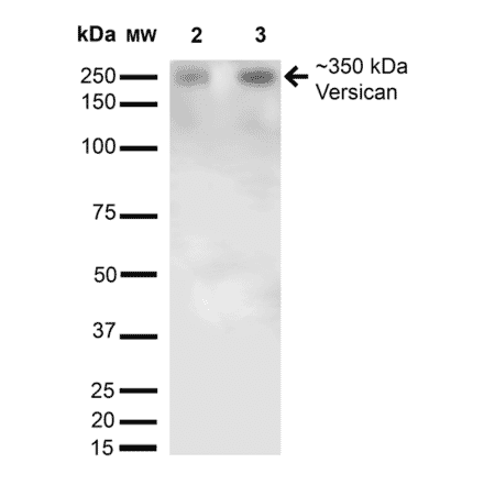 Western Blot - Anti-Versican Antibody [S351-23] (A305042) - Antibodies.com