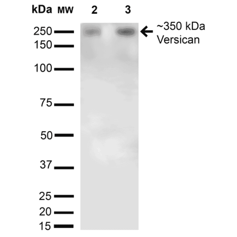 Western Blot - Anti-Versican Antibody [S351-23] (A305042) - Antibodies.com