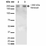 Western Blot - Anti-Versican Antibody [S351-23] (A305042) - Antibodies.com