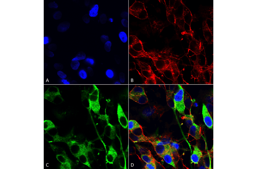 Immunocytochemistry/Immunofluorescence - Anti-Versican Antibody [S351-23] (A305042) - Antibodies.com