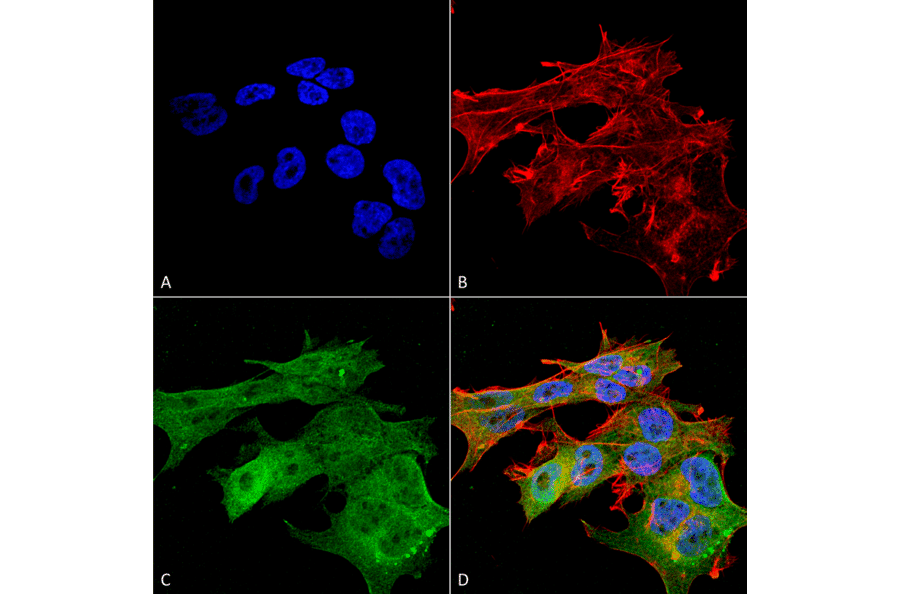 Immunocytochemistry/Immunofluorescence - Anti-Versican Antibody [S351-23] (A305042) - Antibodies.com