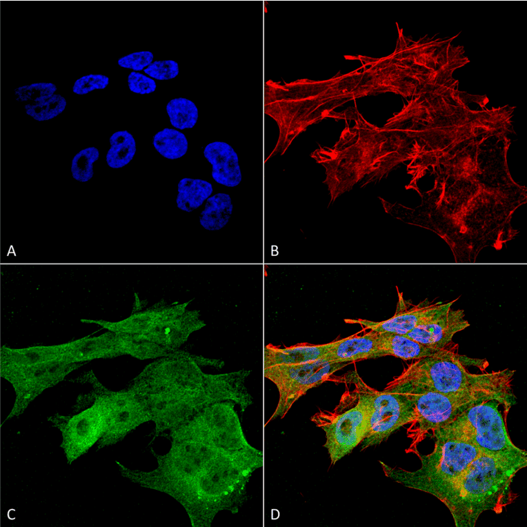 Immunocytochemistry/Immunofluorescence - Anti-Versican Antibody [S351-23] (A305042) - Antibodies.com