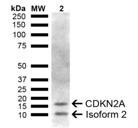 Western Blot - Anti-CDKN2A Antibody (A305043) - Antibodies.com