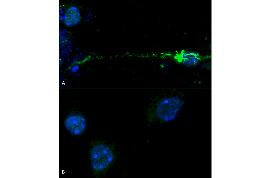 Immunohistochemistry  - Anti-alpha Synuclein (phospho Ser129) Antibody (A305044) - Antibodies.com