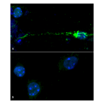 Immunohistochemistry  - Anti-alpha Synuclein (phospho Ser129) Antibody (A305044) - Antibodies.com