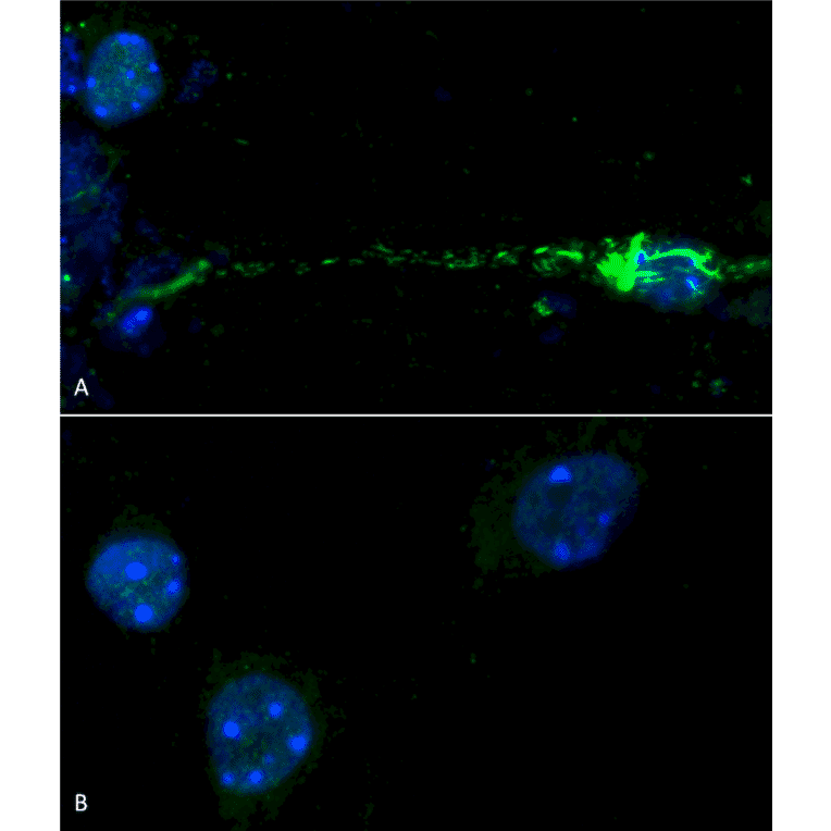 Immunohistochemistry  - Anti-alpha Synuclein (phospho Ser129) Antibody (A305044) - Antibodies.com