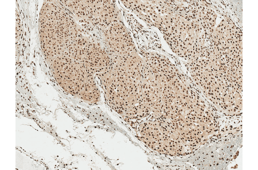 Immunohistochemistry - Anti-alpha Synuclein (phospho Ser129) Antibody (A305044) - Antibodies.com